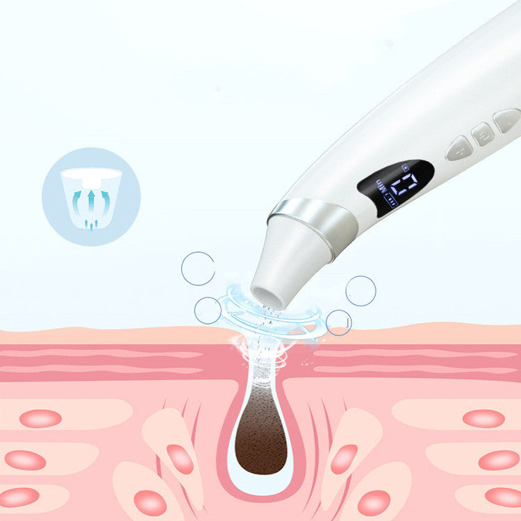 Smart Blackhead Suction Device