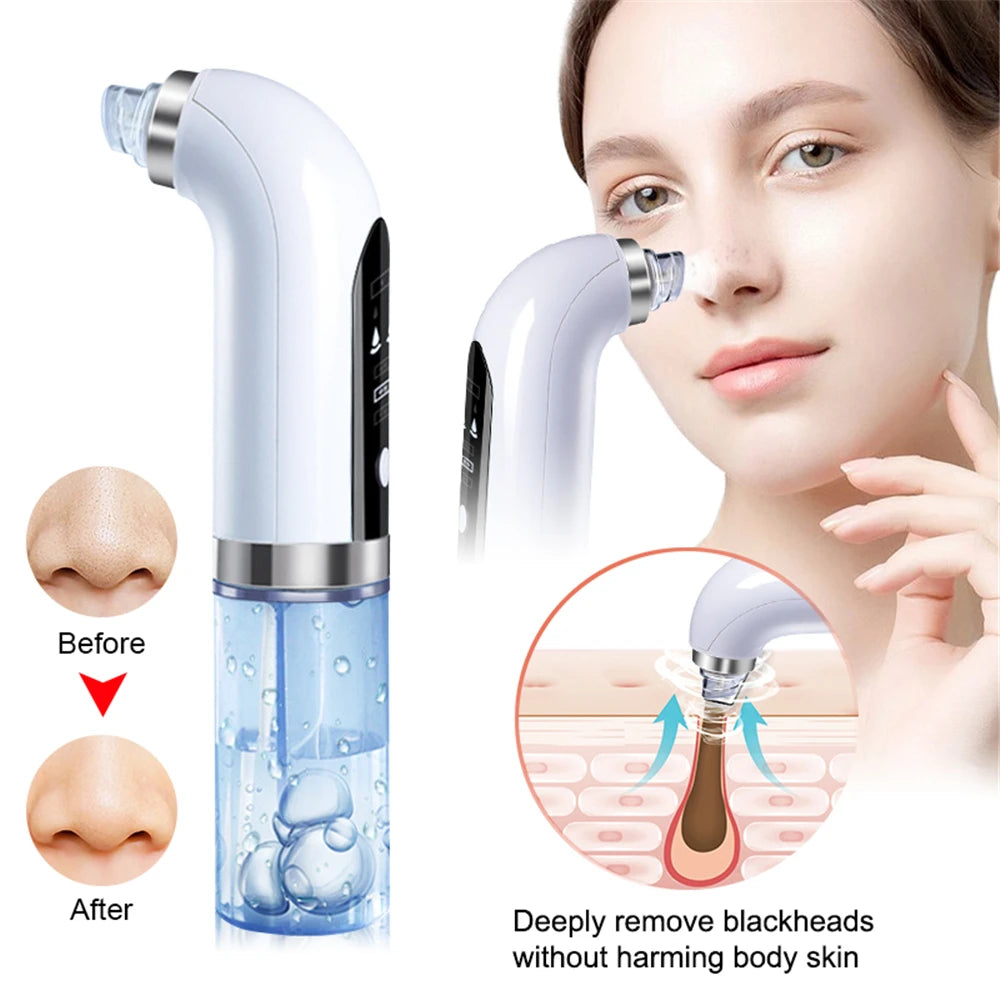 Electric  Blackhead and Pimple Remover