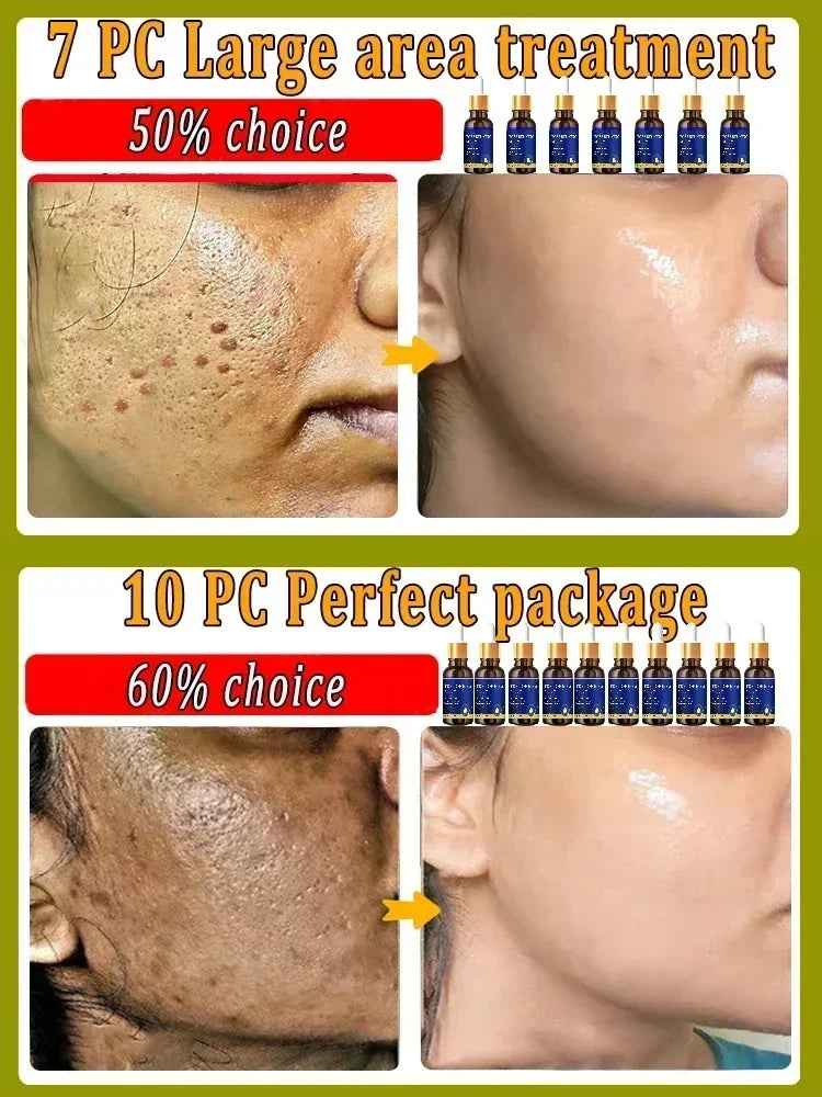 Removing Large Pore  Serum