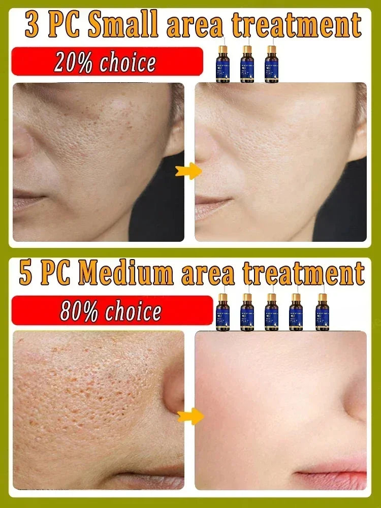 Removing Large Pore  Serum