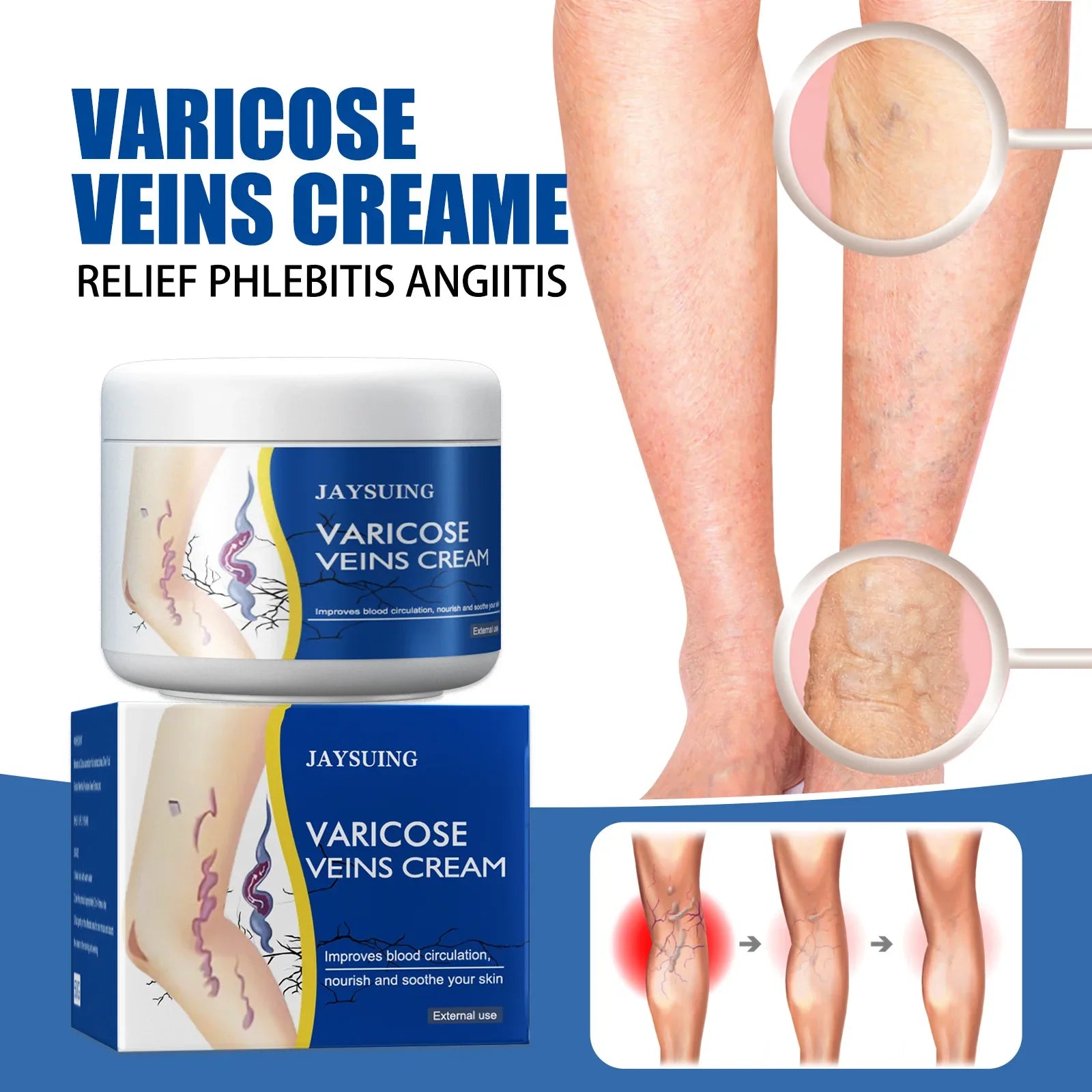 Varicose Repair Cream