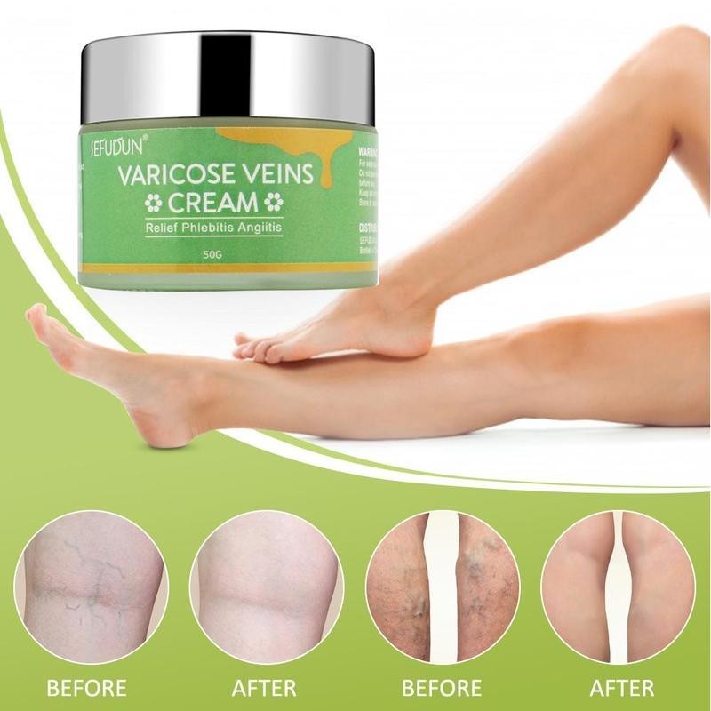 Varicose Cream Repair